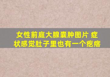 女性前庭大腺囊肿图片 症状感觉肚子里也有一个疙瘩